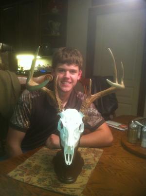 My skull